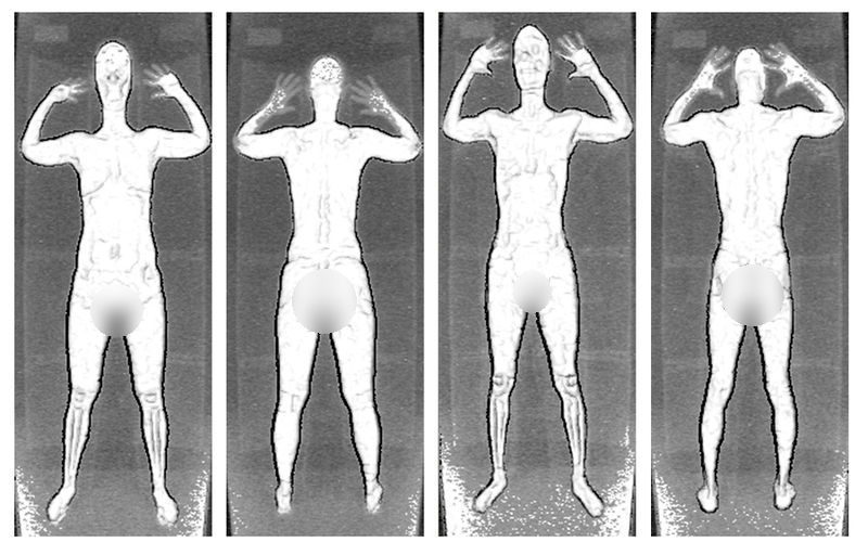 This is an example of an image projected by a full-body scanner equipped with X-ray backscatter technology. Portions of the image which may be deemed offensive by some readers have been blurred out. Image courtesy of the Transportation Security Administration.