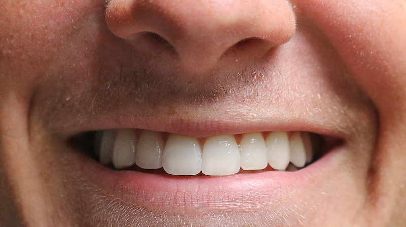 smile teeth mouth